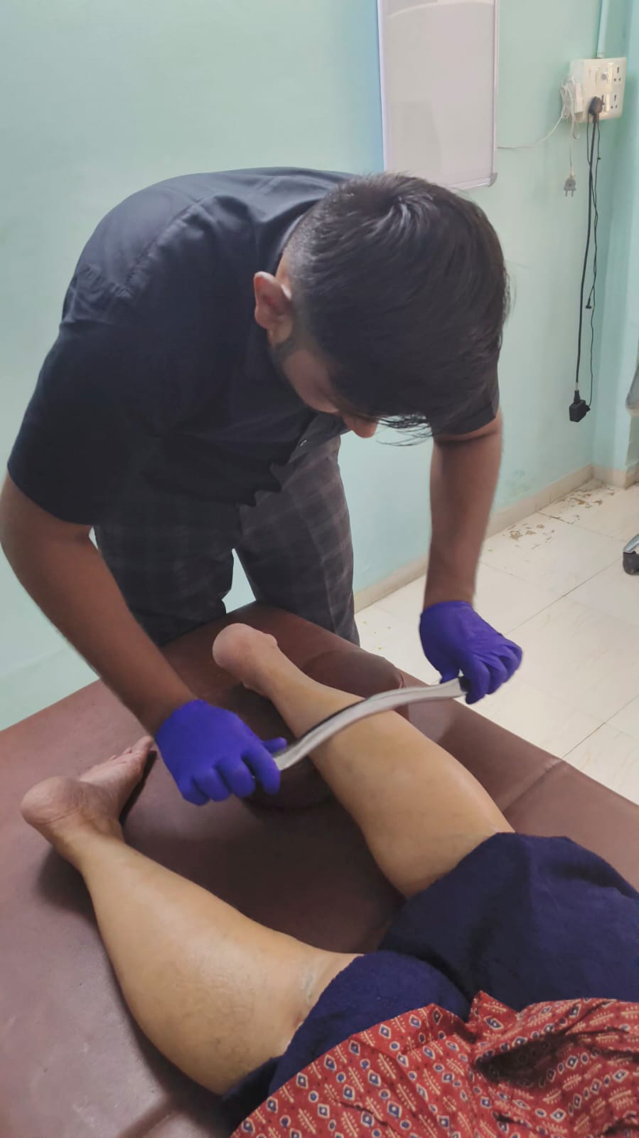 Dry needling therapy for pain relief at Spine-X Chiropractic
