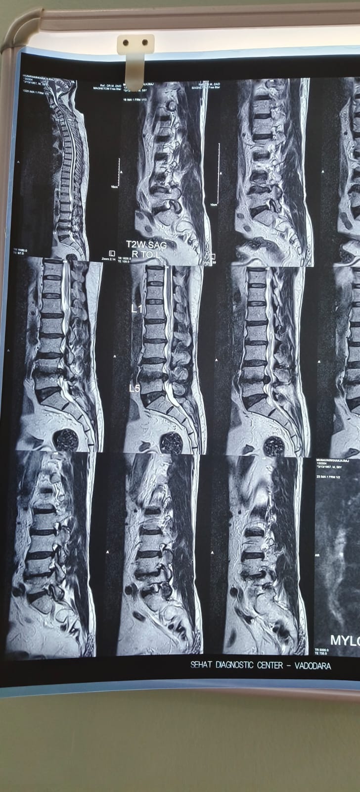 Pain management treatment session at Spine-X Chiropractic