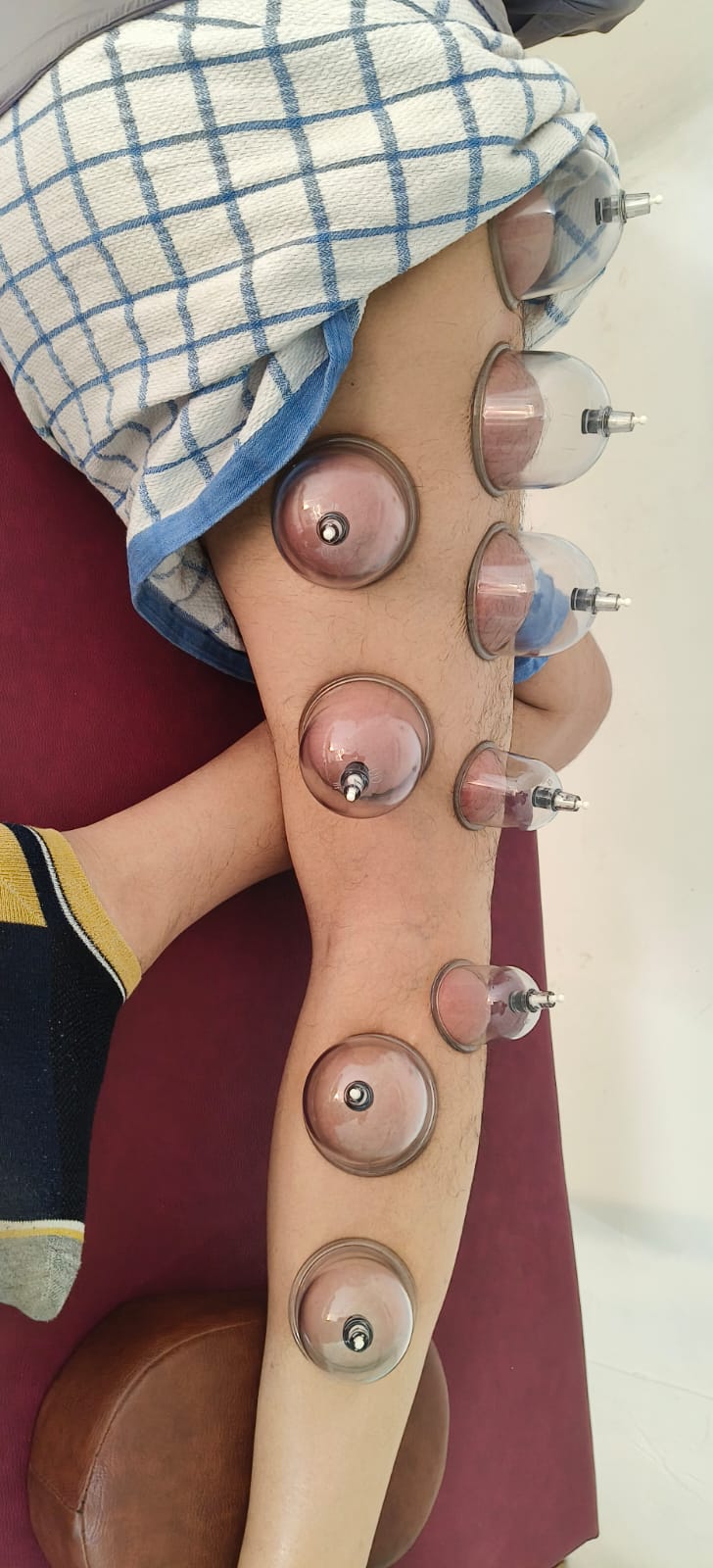 Exercise therapy session for rehabilitation at Spine-X Chiropractic